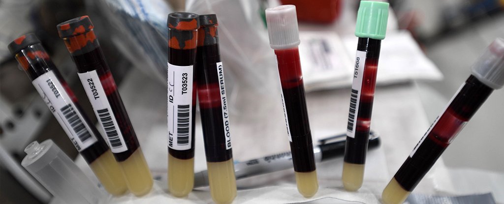 Featured image for "Space Travel's Impact on Astronauts' Red Blood Cells Revealed"