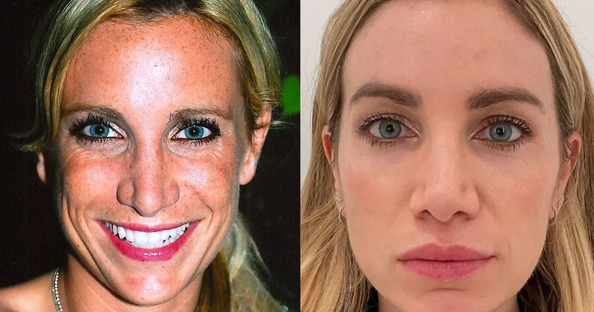 Featured image for A Decade-Long Effort to Remove Sun Spots