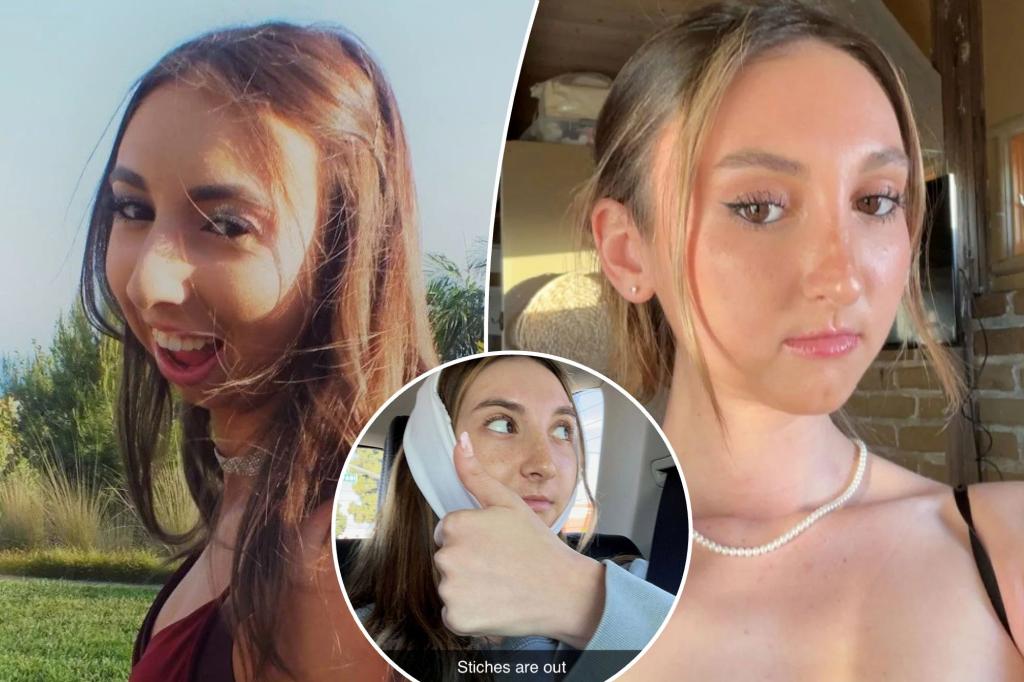 Bullied for Looking Like a Squirrel: Woman Spends $200K on Jaw Surgery.