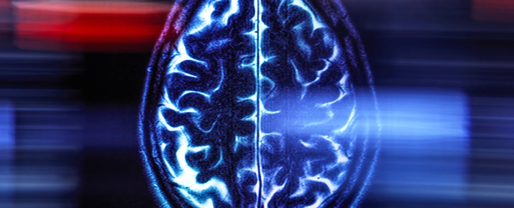 Featured image for Brain scans can reveal your true biological age and aging speed