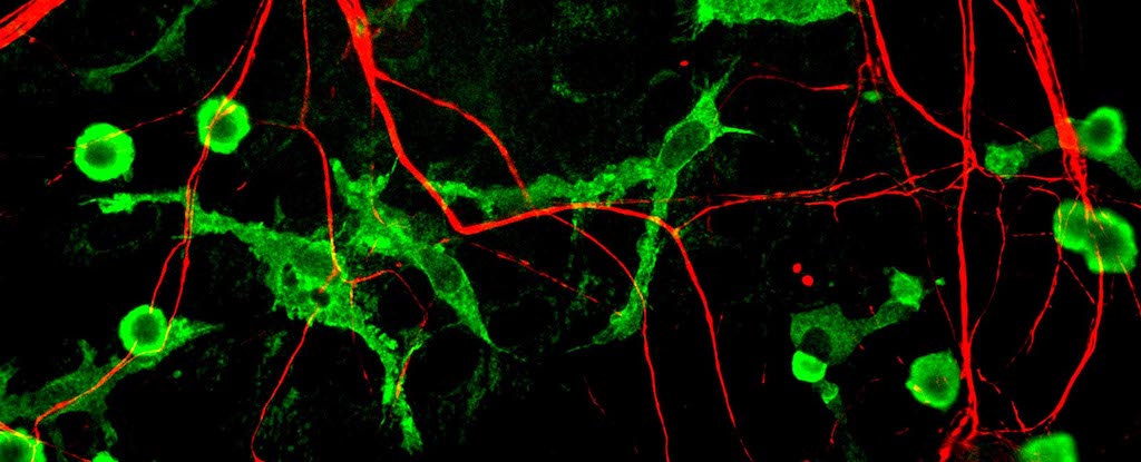 "Exercise Proven to Combat Age-Related Brain Decline"