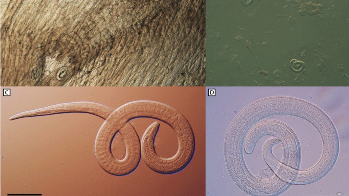 Featured image for Family Contracts Brain Worms from Undercooked Bear Meat