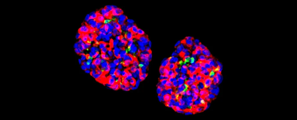 Insulin Production in Human Cells Reverses Diabetes in Mice: Scientists Hack Cells.