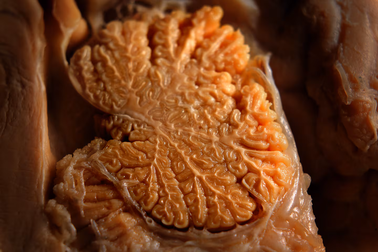 Featured image for Mass. Brain Bank Faces Closure and Budget Cuts Threatening Disease Research