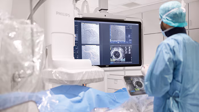 Featured image for Philips to Acquire SpectraWAVE to Enhance AI Coronary Imaging