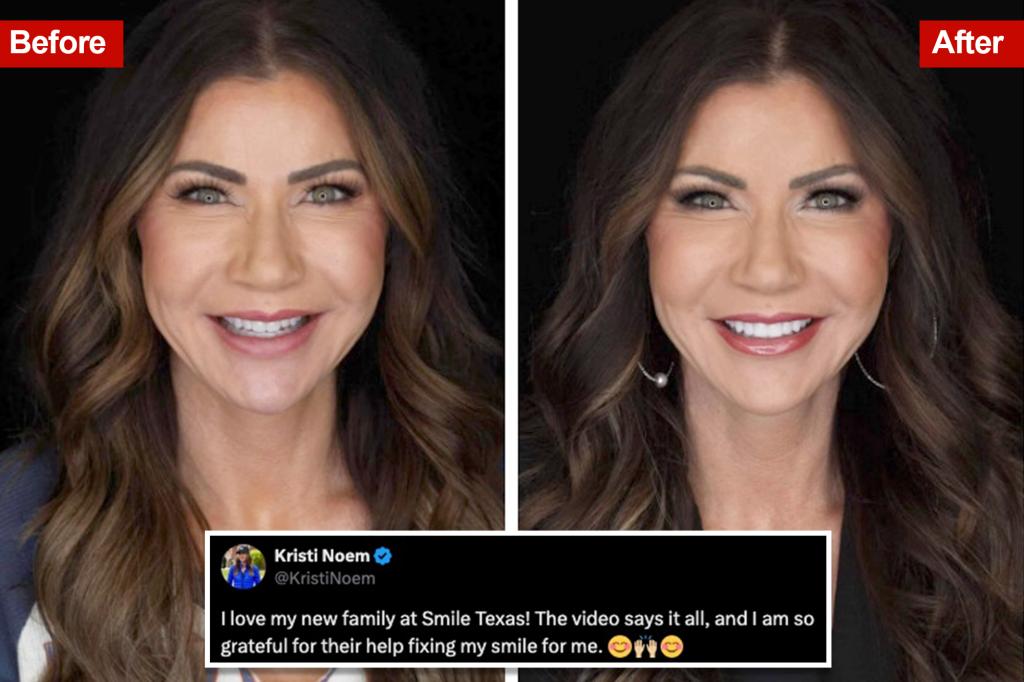 Lawsuit Filed Against South Dakota Governor Noem Over Texas Dentist Endorsement