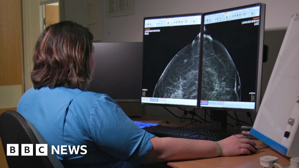 AI trial in Aberdeen improves breast cancer detection for doctors.