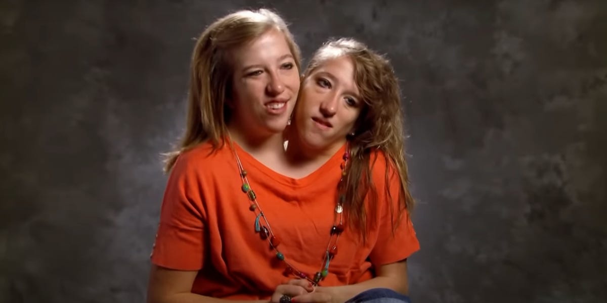 Featured image for "Conjoined Twin Abby Hensel Ties the Knot: Addressing Social Media Attention"