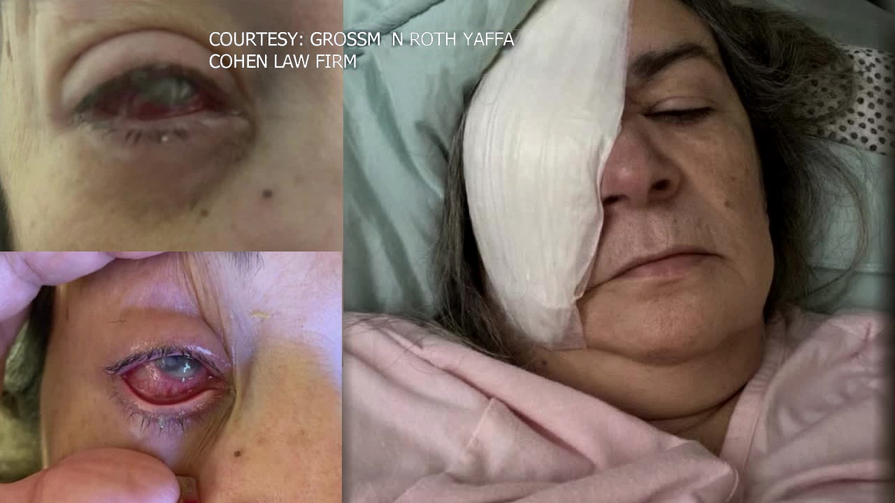 The Devastating Consequences of Using Infected Eye Drops