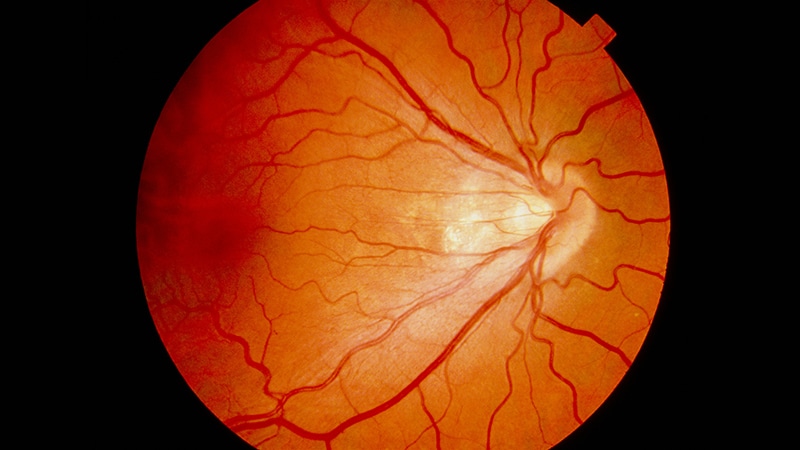 Link Between Parenteral Nutrition and Retinopathy of Prematurity Discovered