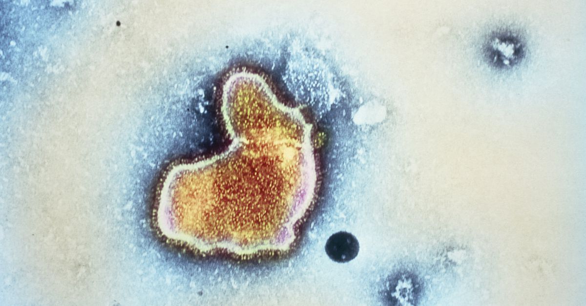 Featured image for RSV Shot Beyfortus in Short Supply: Navigating the Crisis