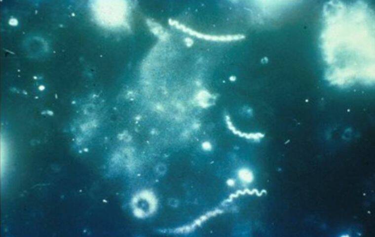 Featured image for "Surge in Syphilis Cases Prompts Urgent Call for Expanded Screening and Treatment"