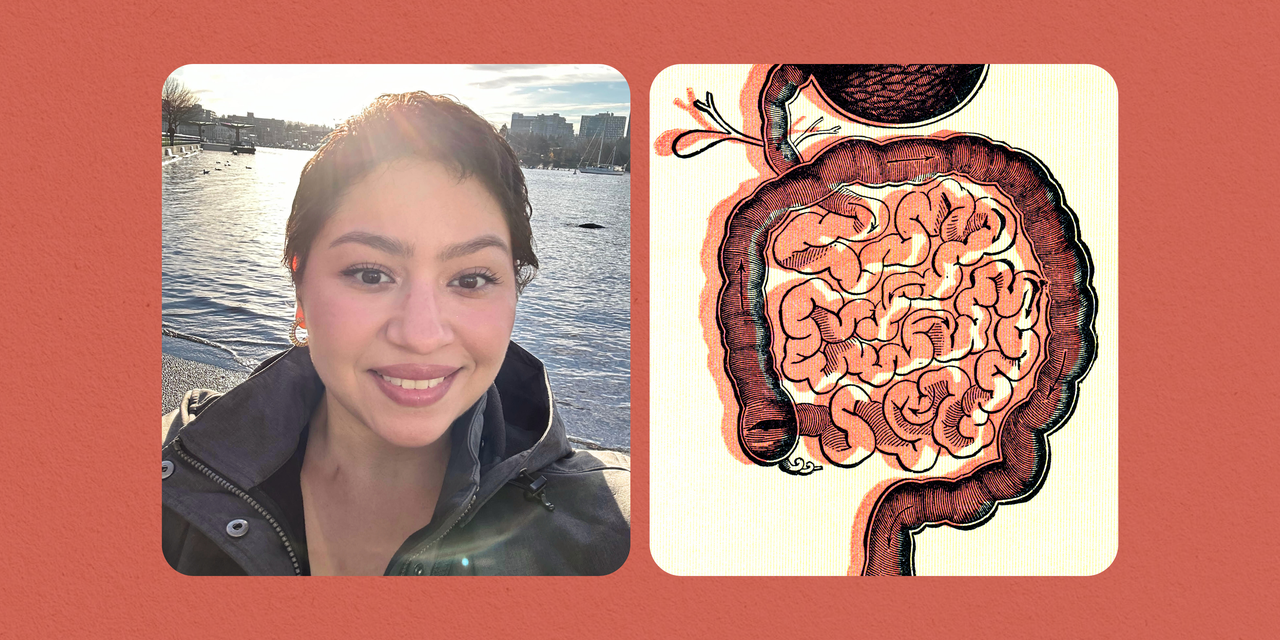 Featured image for "Recognizing Early Signs of Colon Cancer: My Experience at 32"