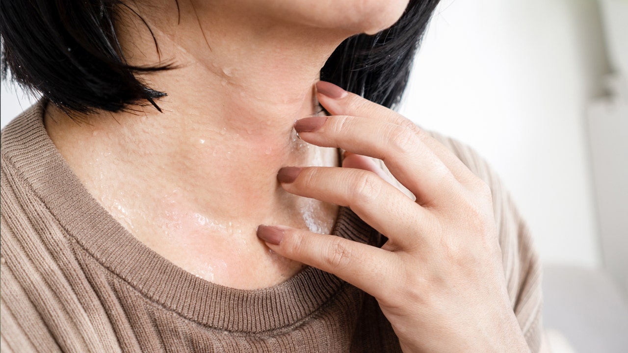 Featured image for "Beat the Heat: Effective Ways to Reduce Excessive Sweating"