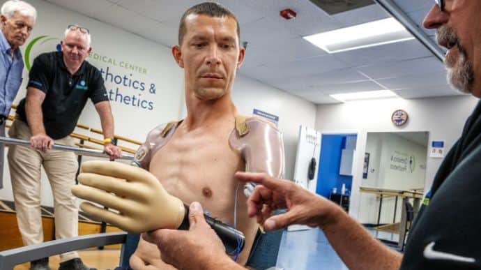 Featured image for "Ukrainian Soldier's Harrowing Tale: Wagnerites Amputate Arms, No Stitching"