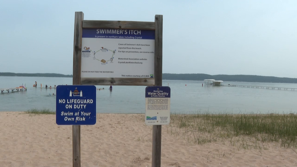 Featured image for Increasing Cases of Swimmer's Itch Plague Crystal Lake