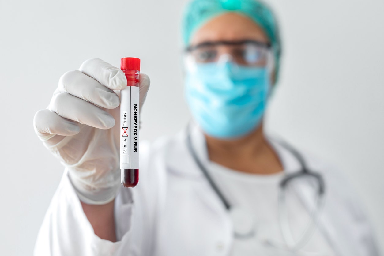 CDC alerts of ongoing mpox transmission and potential summer risk.