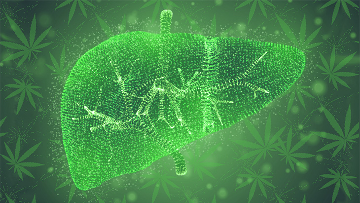 "Cannabis Use Linked to Reduced Risk of Fatty Liver Disease"