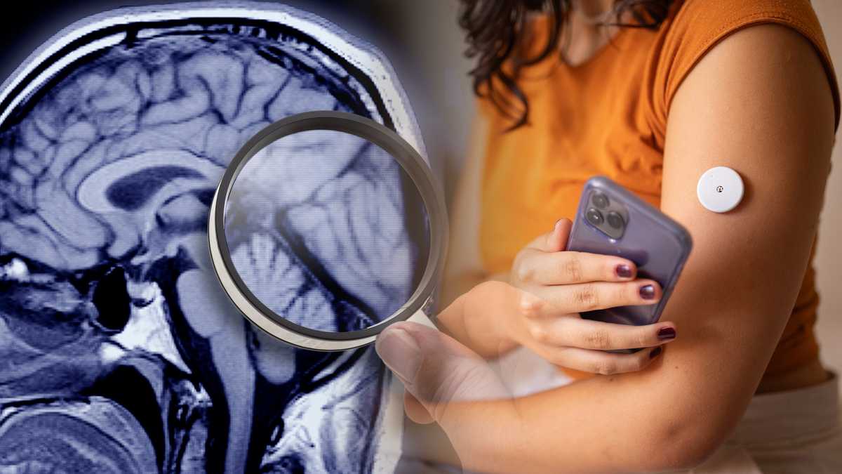 Featured image for "Study Links Diabetes to Increased Alzheimer's Risk"