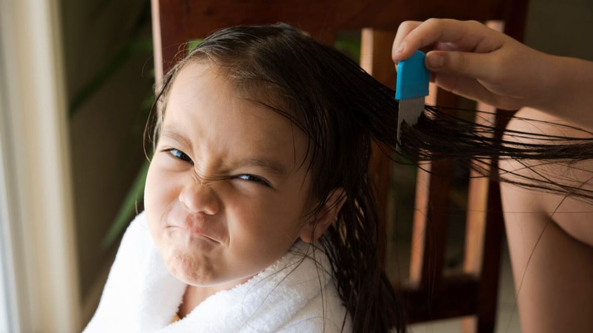 Featured image for "The Truth About Lice: Who is Most Susceptible and How it Spreads"