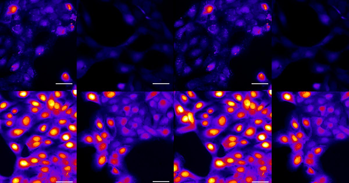 Featured image for Lidocaine's Cancer Cell Self-Destruction Unveiled in Study