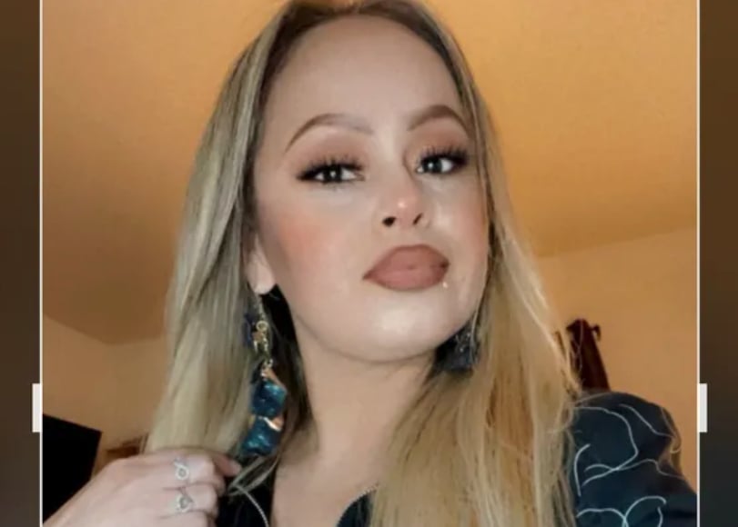 Featured image for San Jose Woman's Limb Loss Mystery Deepens