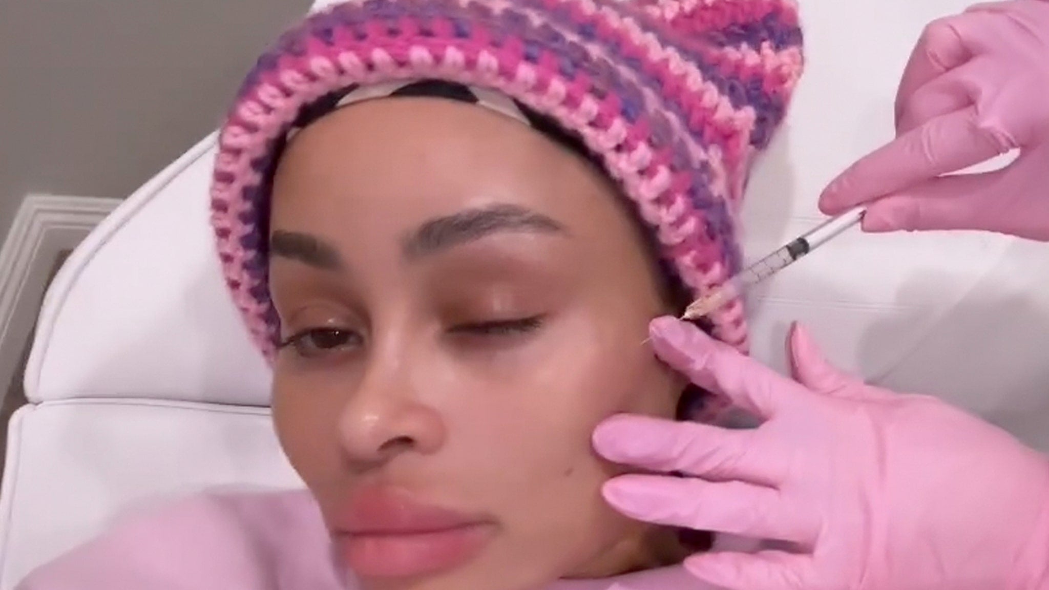 Blac Chyna Dissolves Facial Fillers and Shares Video.
