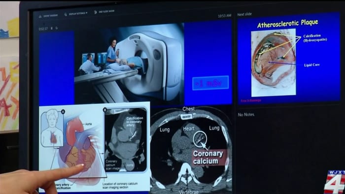 Featured image for "Essential Facts about Calcium Supplements and Calcium-Rich Foods"
