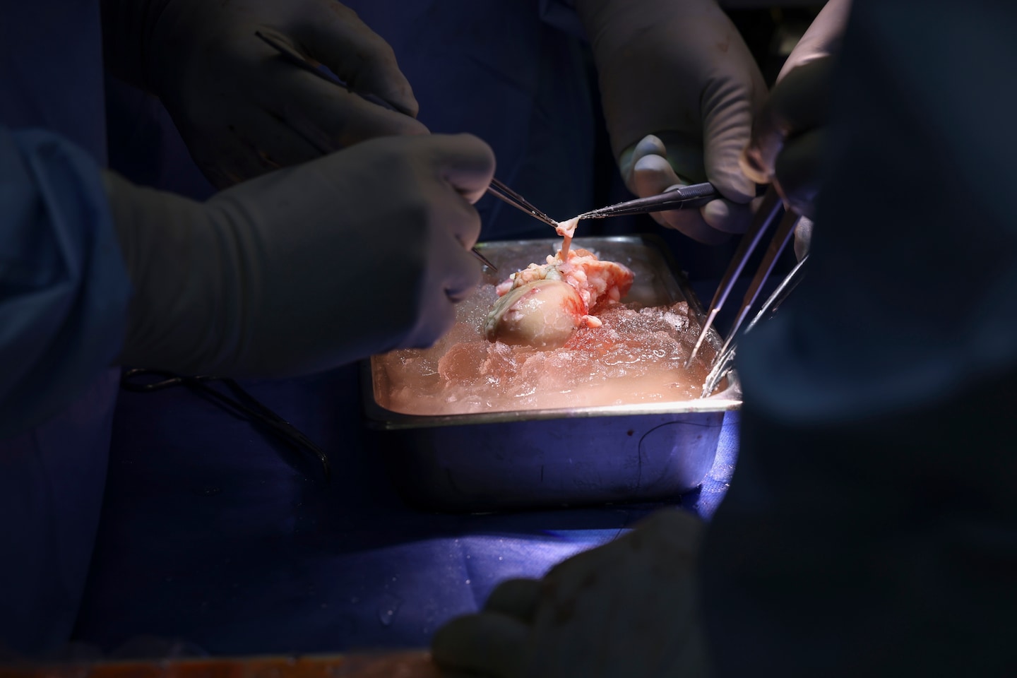 Featured image for "First Living Patient with Pig Kidney Transplant Discharged from Hospital"
