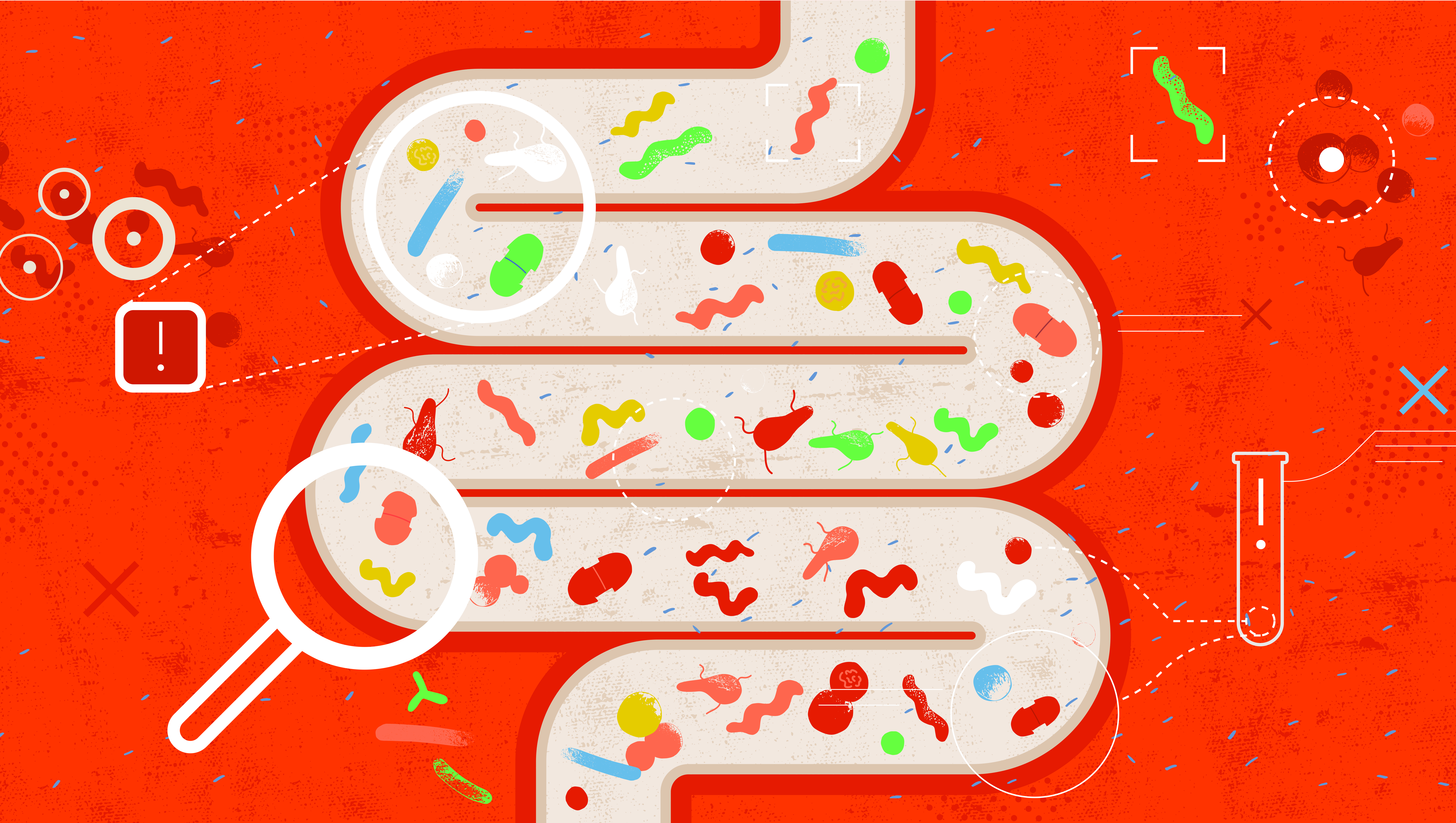 The Connection Between Chronic Constipation and Cognitive Decline