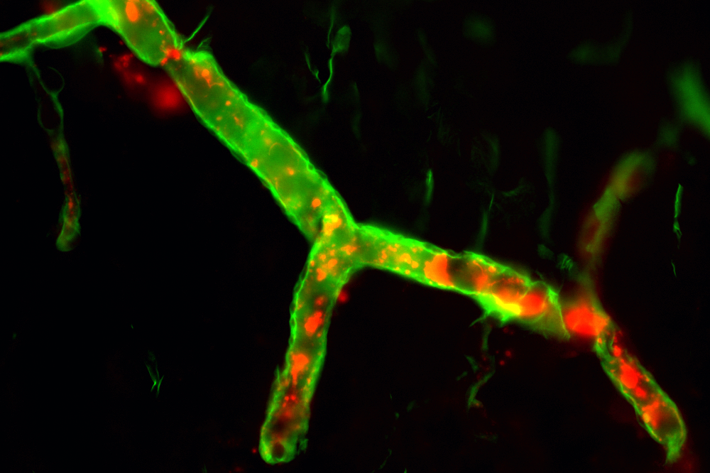 The Link Between Gut Microbiome and Multiple Sclerosis Risk