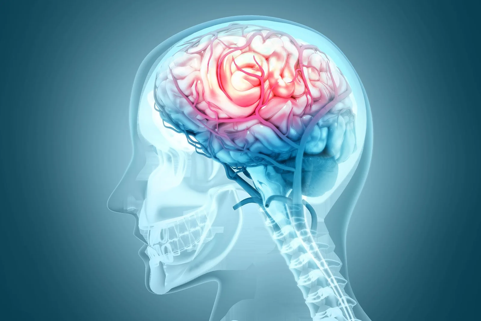 Hidden Brain Vessel Protein Tied to Quadrupled Dementia Risk