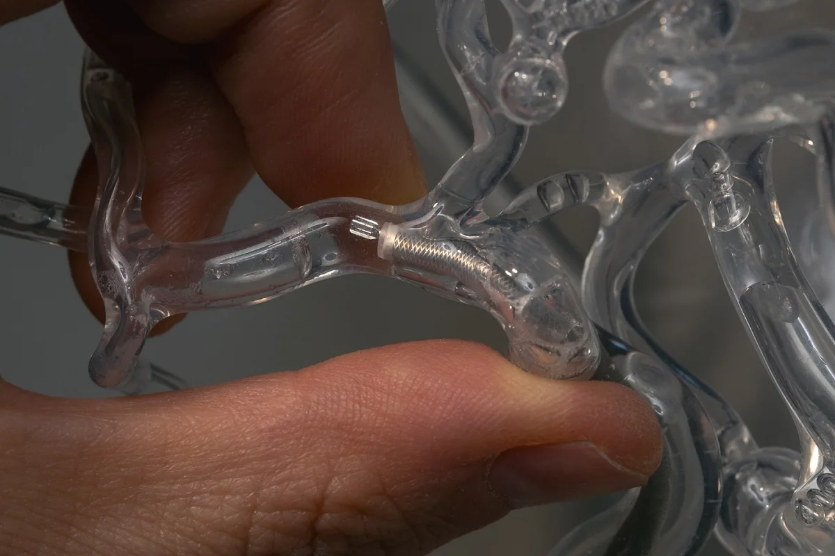 Featured image for Stanford Unveils Innovative Device to Double Stroke Clot Removal Success