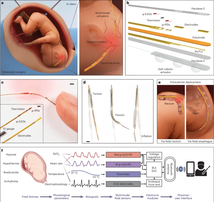 Soft-filament probe enables real-time multimodal fetal monitoring in utero