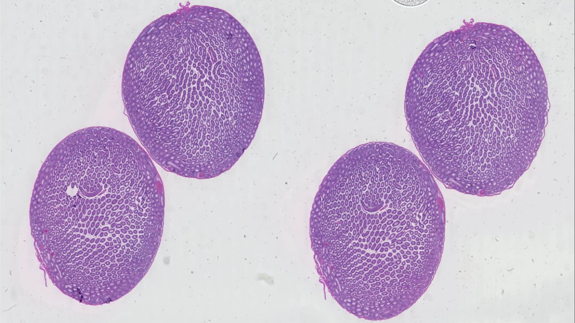 Featured image for AI Revolutionizes Rapid Disease and Cancer Detection