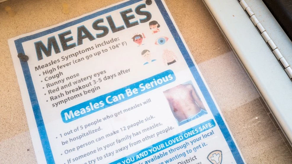 Featured image for Measles Outbreak Expands in Eastern Iowa with Multiple Cases and Exposures