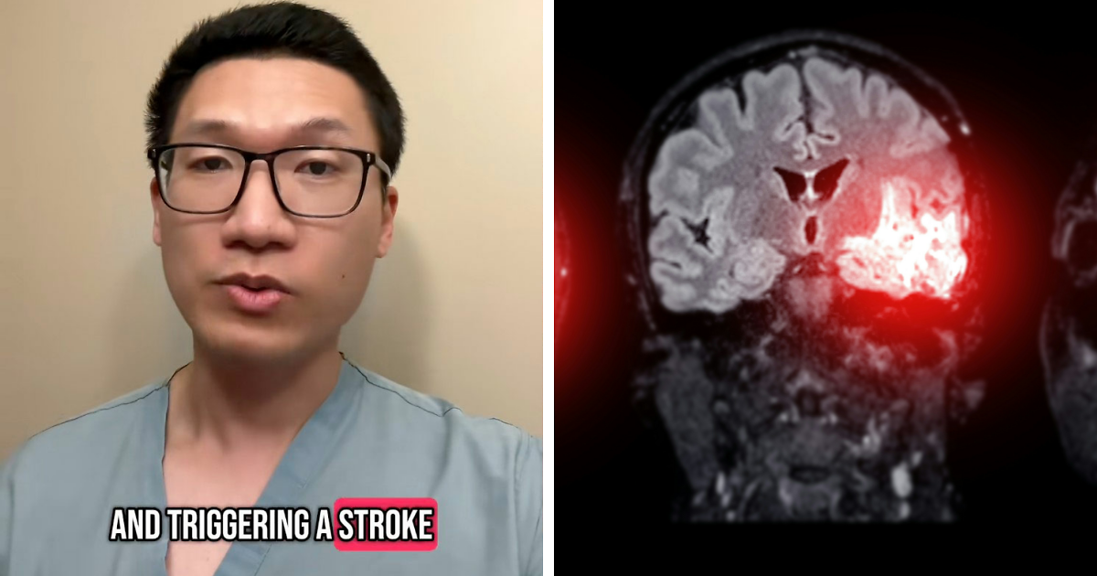 Featured image for Neurologist Cautions on Post-Exercise Habit Linked to Strokes and Dementia