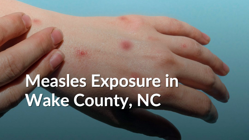Measles Exposure Alerts in North Carolina Amid Holiday Travel