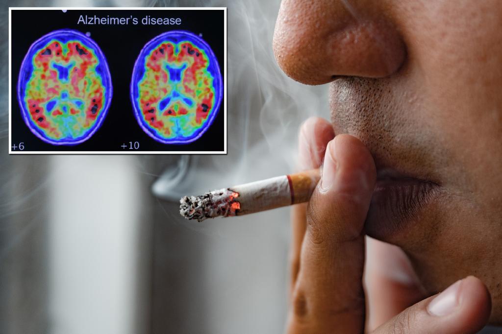 Featured image for "Study Links Smoking to Brain Shrinkage and Elevated Alzheimer's Risk"