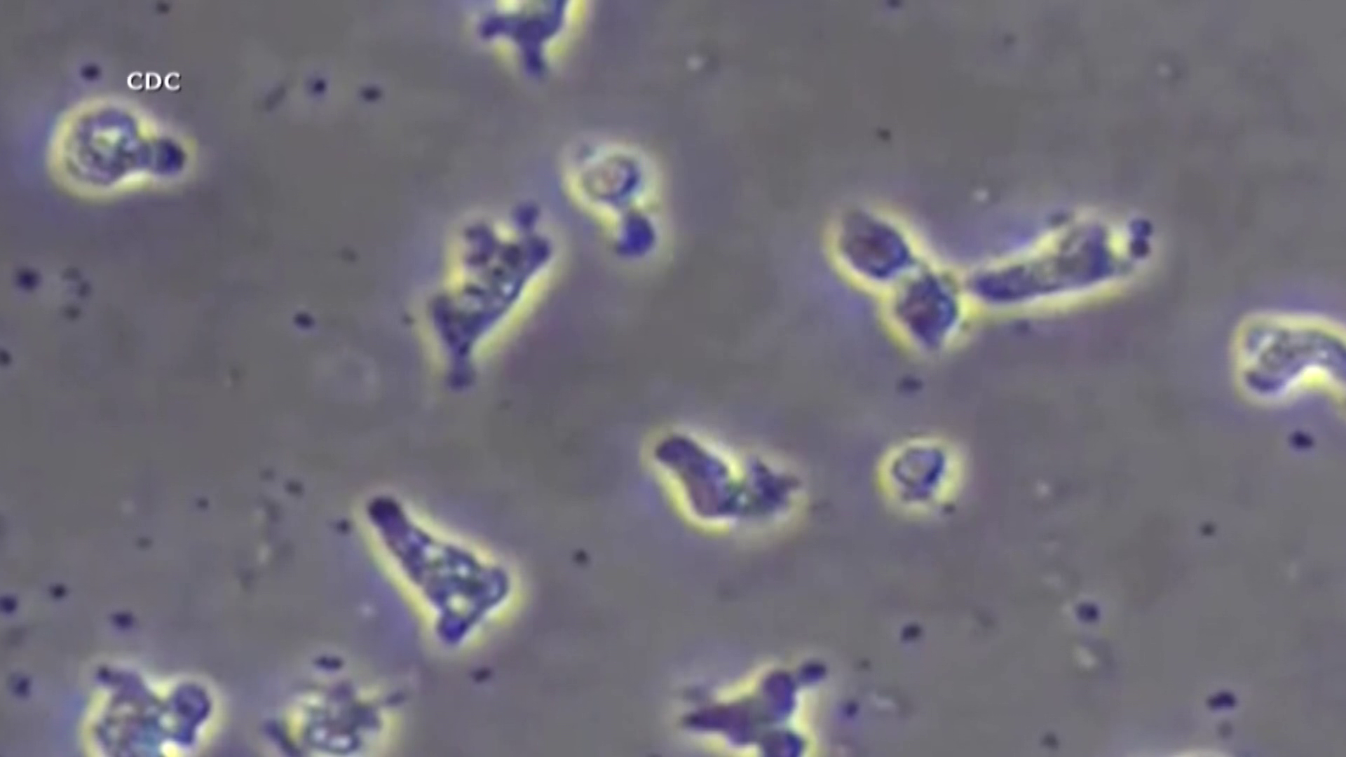 Featured image for Unresolved Concerns Surrounding Brain-Eating Amoeba Outbreak.