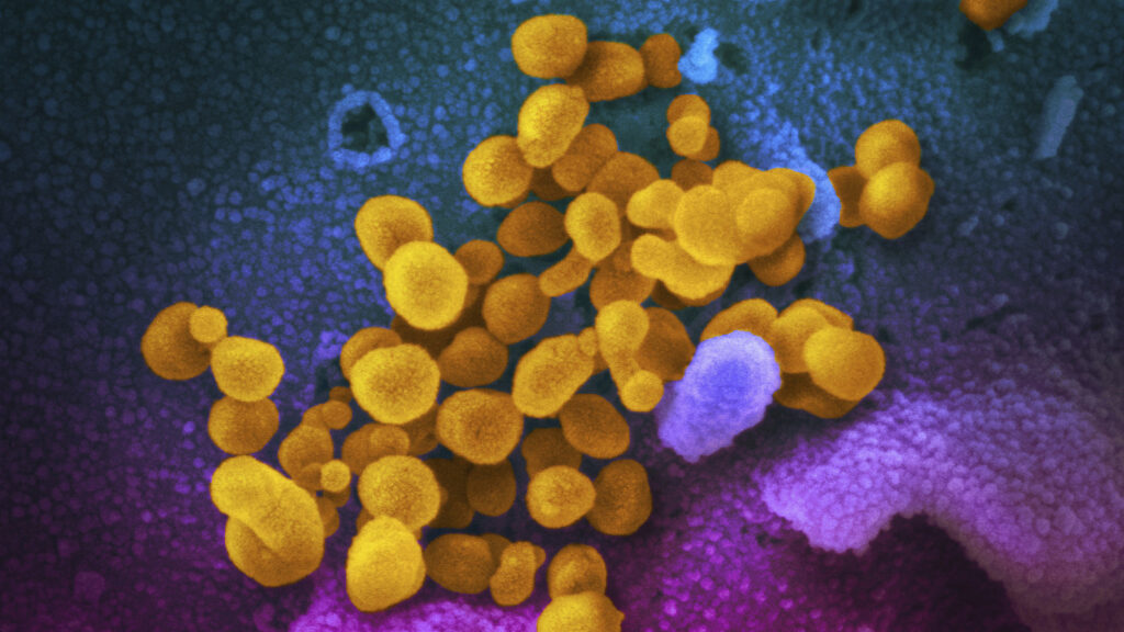 Featured image for "Insights from Immunocompromised Patients Shed Light on Chronic Covid"