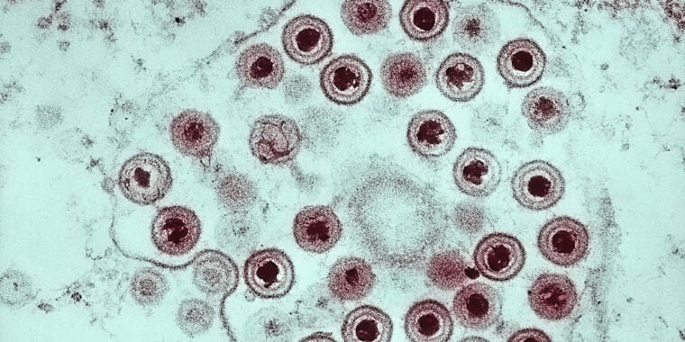 Featured image for Discovery of Link between Herpesviruses and Giant Viruses.