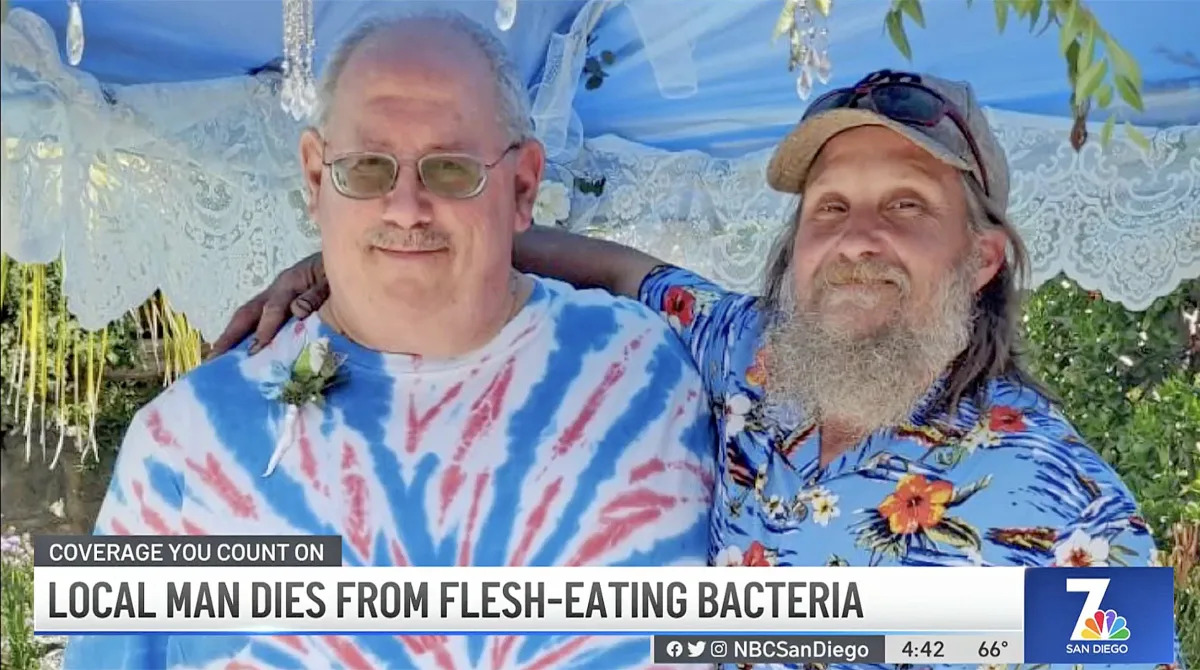 Fatal Encounter: Man Dies from Flesh-Eating Bacteria After Pond Mishap