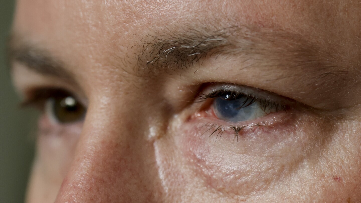 Featured image for Revolutionary Stem Cell Therapy Restores Vision in Eye Injuries