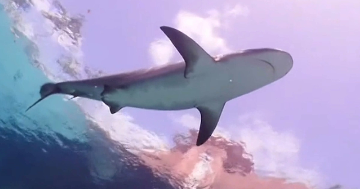 10-Year-Old Boy Attacked by Shark at Bahamas Resort