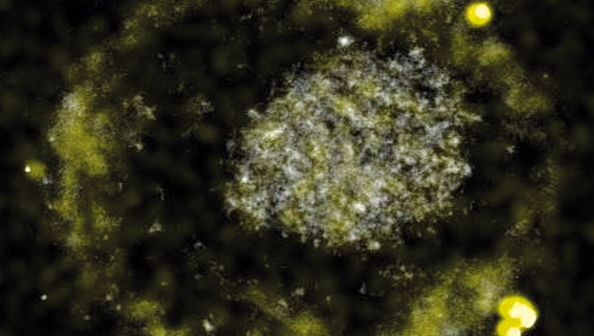 Featured image for Tiny Bacterium Turns Heavy Metal into Gold