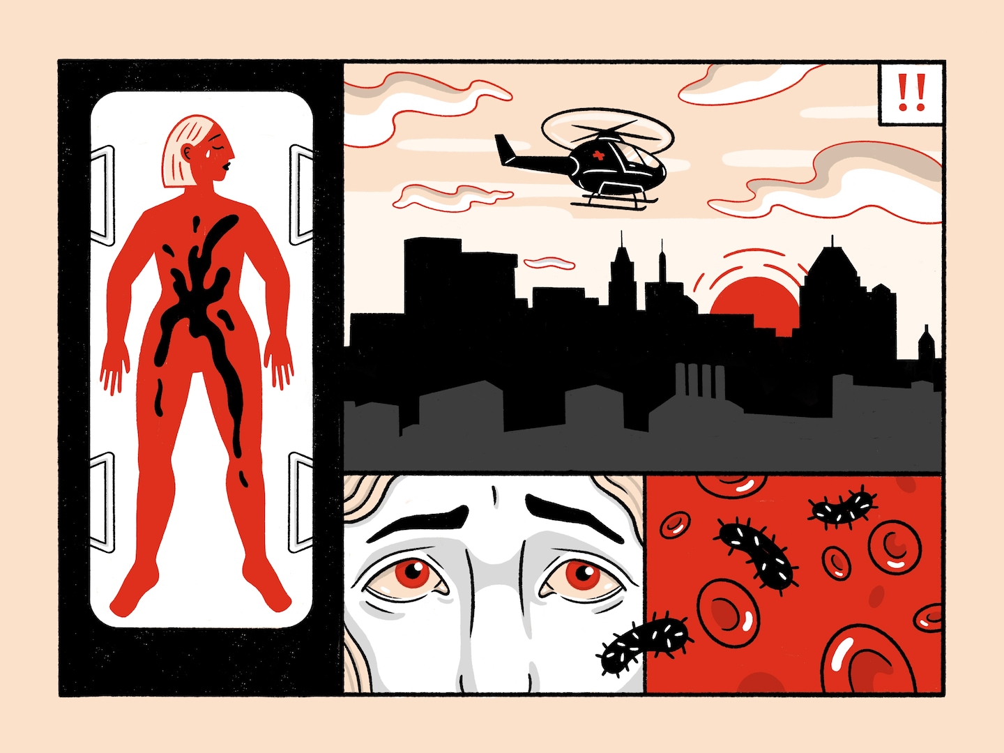 Surviving Septic Shock: Recognizing the Red Flags