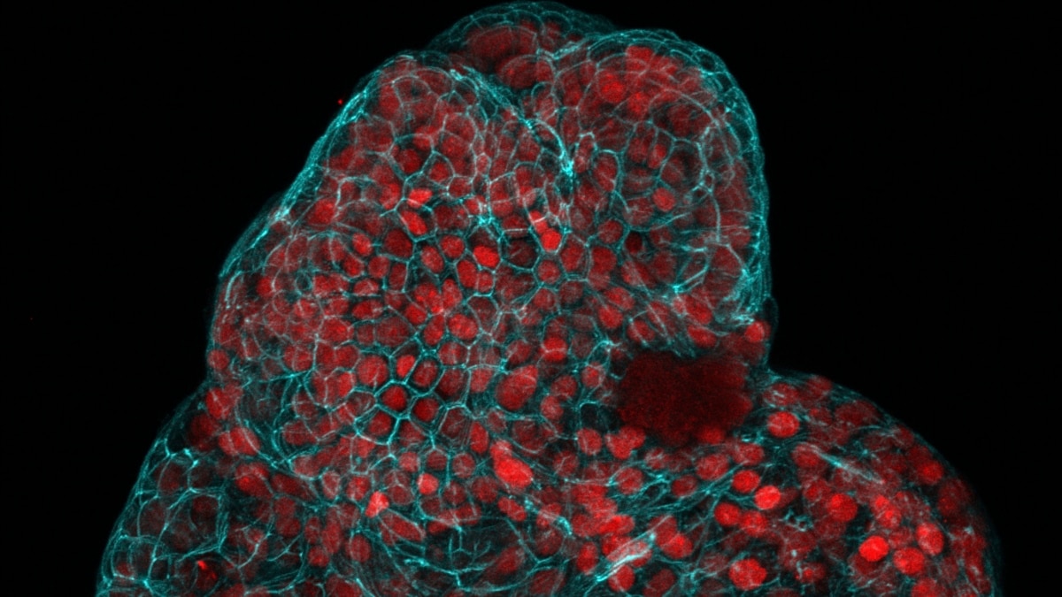 Featured image for "Amniotic Fluid Cells Yield Breakthrough in Mini-Organ Growth"