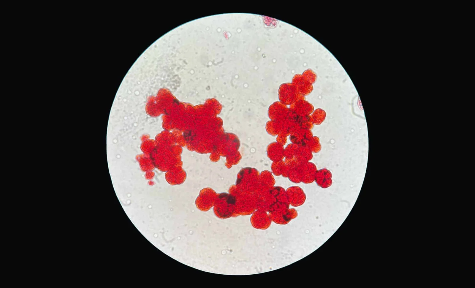 Featured image for Scientists Find Organism That Challenges Life's Fundamentals