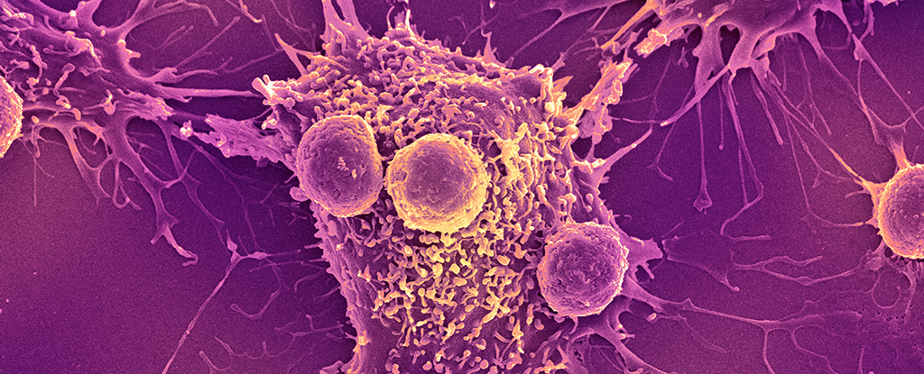 Promising Off-the-Shelf Vaccine Shows Efficacy Against Deadly Cancers